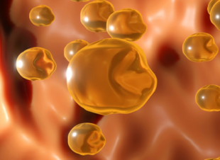 أسوأ أنواع الأطعمة المسببة لزيادة الكوليسترول!